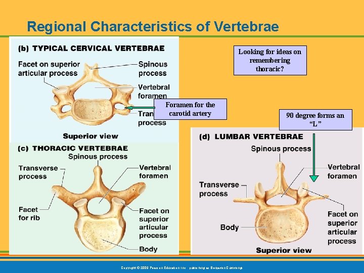 Regional Characteristics of Vertebrae Looking for ideas on remembering thoracic? Foramen for the carotid
