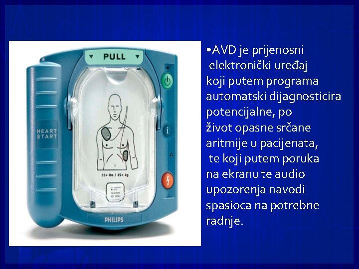  • AVD je prijenosni elektronički uređaj koji putem programa automatski dijagnosticira potencijalne, po