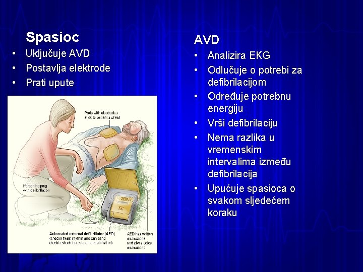 Spasioc • Uključuje AVD • Postavlja elektrode • Prati upute AVD • Analizira EKG