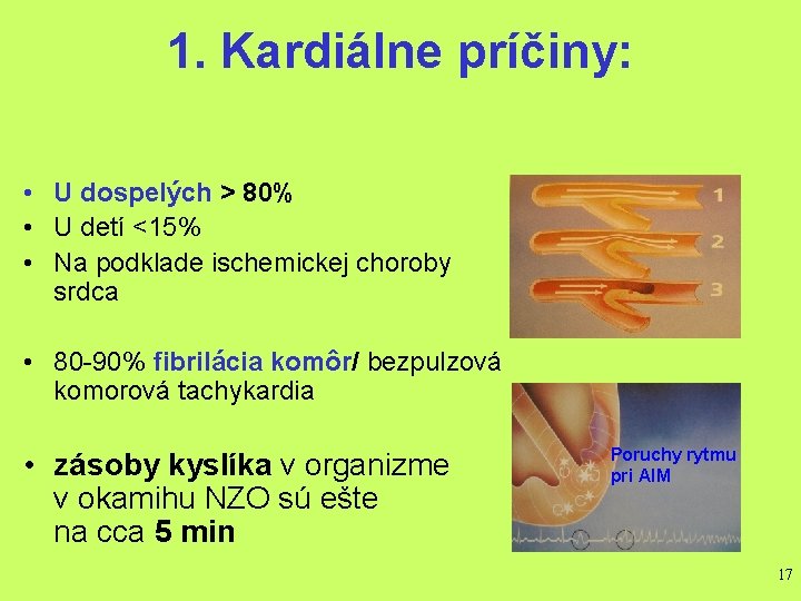 1. Kardiálne príčiny: • U dospelých > 80% • U detí <15% • Na