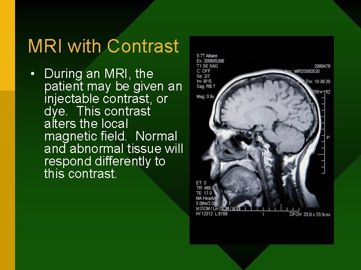 MRI with Contrast • During an MRI, the patient may be given an injectable