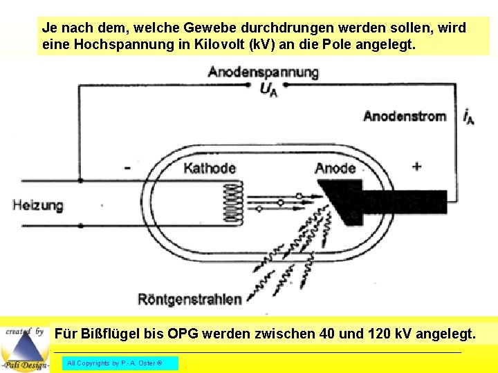 Je nach dem, welche Gewebe durchdrungen werden sollen, wird eine Hochspannung in Kilovolt (k.