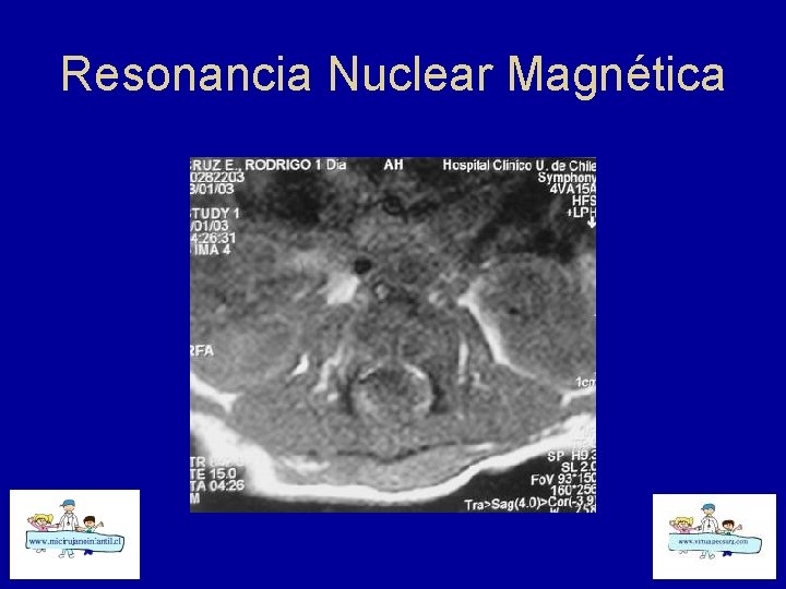 Resonancia Nuclear Magnética 