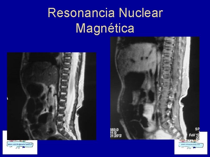 Resonancia Nuclear Magnética 