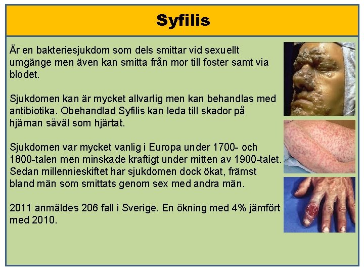 Syfilis Är en bakteriesjukdom som dels smittar vid sexuellt umgänge men även kan smitta