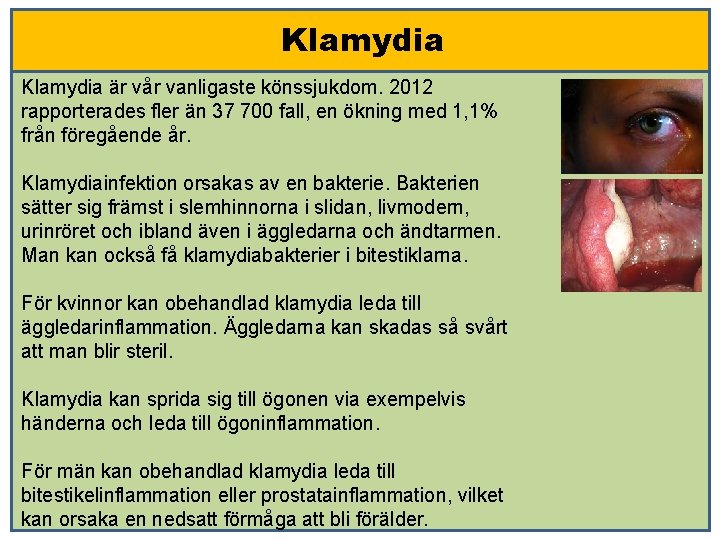 Klamydia är vår vanligaste könssjukdom. 2012 rapporterades fler än 37 700 fall, en ökning