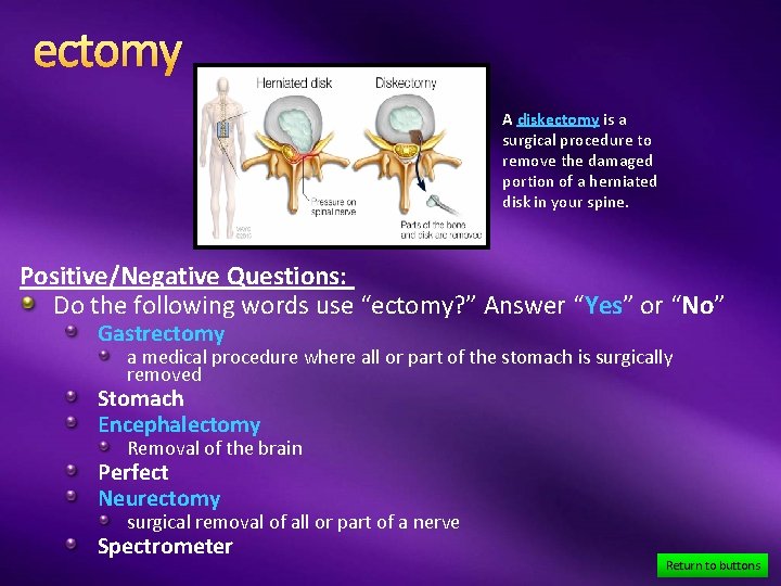 ectomy A diskectomy is a surgical procedure to remove the damaged portion of a