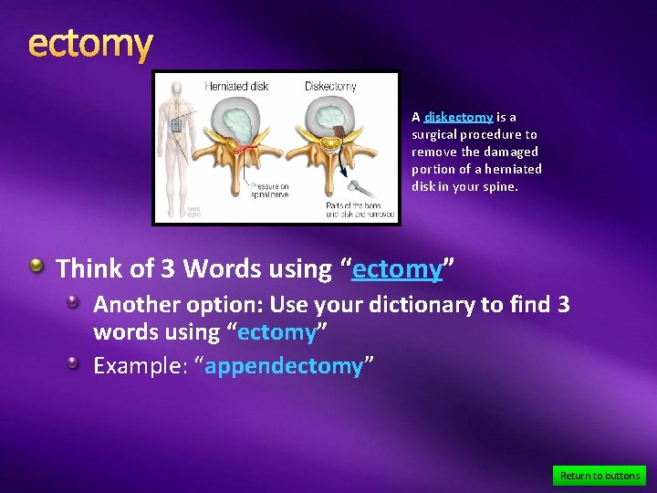 ectomy A diskectomy is a surgical procedure to remove the damaged portion of a