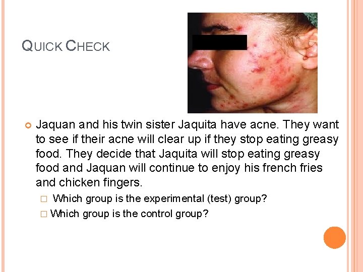 QUICK CHECK Jaquan and his twin sister Jaquita have acne. They want to see