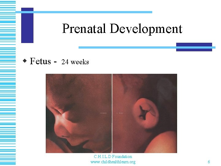 Prenatal Development w Fetus - 24 weeks C. H. I. L. D Foundation www.