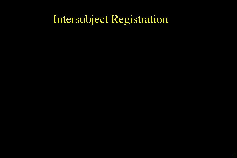 Intersubject Registration 11 