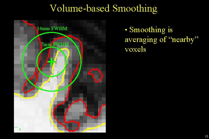 Volume-based Smoothing 14 mm FWHM 7 mm FWHM • Smoothing is averaging of “nearby”