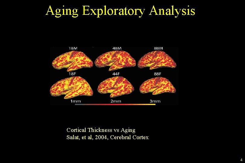 Aging Exploratory Analysis Cortical Thickness vs Aging Salat, et al, 2004, Cerebral Cortex 4