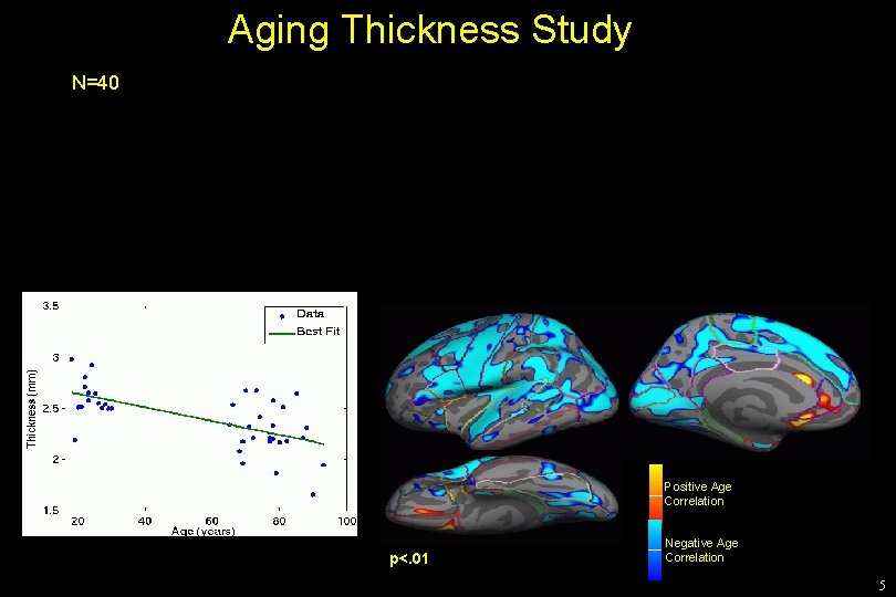 Aging Thickness Study N=40 Positive Age Correlation p<. 01 Negative Age Correlation 5 