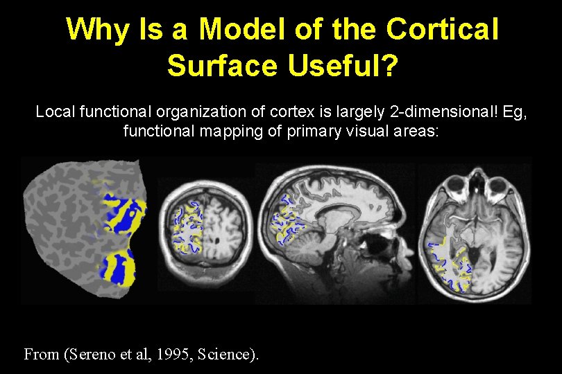 Why Is a Model of the Cortical Surface Useful? Local functional organization of cortex