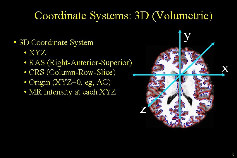 Coordinate Systems: 3 D (Volumetric) y • 3 D Coordinate System • XYZ •