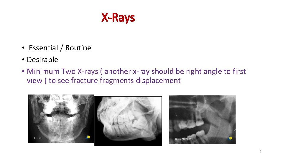 X-Rays • Essential / Routine • Desirable • Minimum Two X-rays ( another x-ray