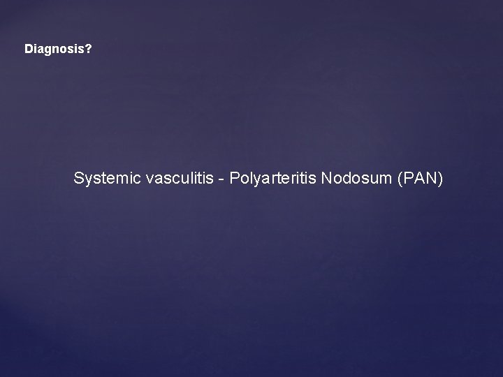 Diagnosis? Systemic vasculitis - Polyarteritis Nodosum (PAN) 