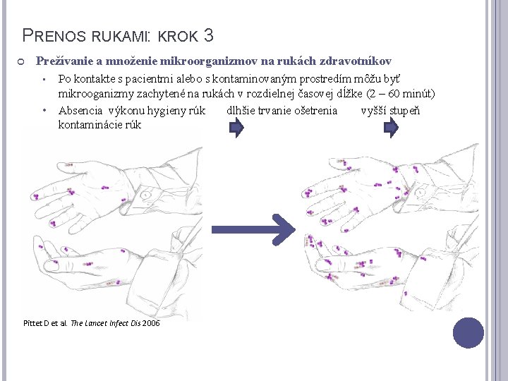 PRENOS RUKAMI: KROK 3 Prežívanie a množenie mikroorganizmov na rukách zdravotníkov Po kontakte s