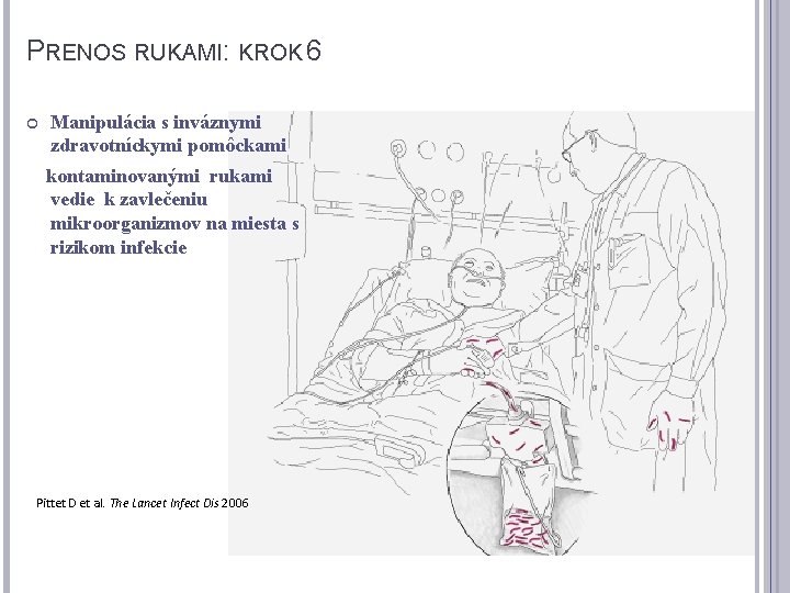 PRENOS RUKAMI: KROK 6 Manipulácia s inváznymi zdravotníckymi pomôckami kontaminovanými rukami vedie k zavlečeniu