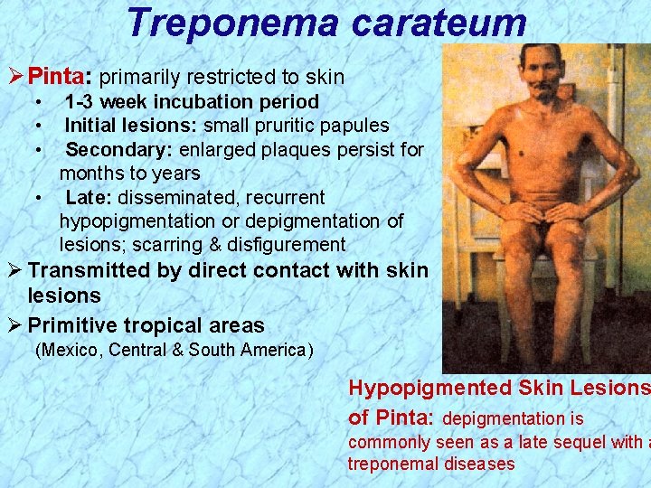 Treponema carateum Ø Pinta: primarily restricted to skin • • • 1 -3 week