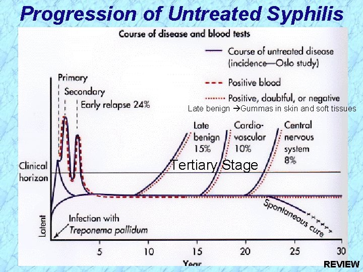 Progression of Untreated Syphilis Late benign Gummas in skin and soft tissues Tertiary Stage