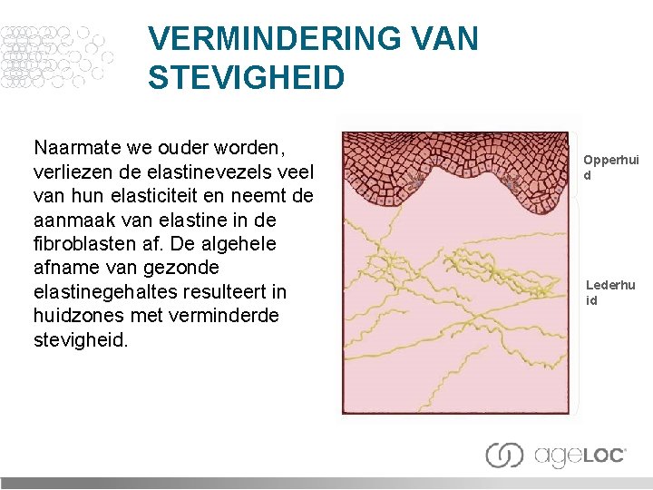 VERMINDERING VAN STEVIGHEID Naarmate we ouder worden, verliezen de elastinevezels veel van hun elasticiteit