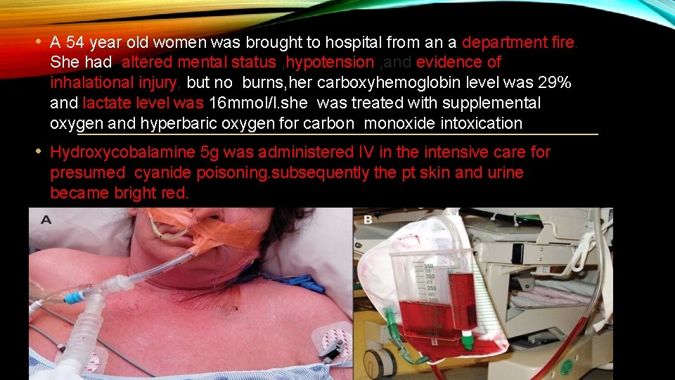  • A 54 year old women was brought to hospital from an a