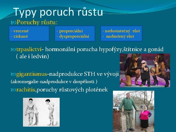 Typy poruch růstu Poruchy růstu: - vrozené - získané - proporciální - dysproporciální -