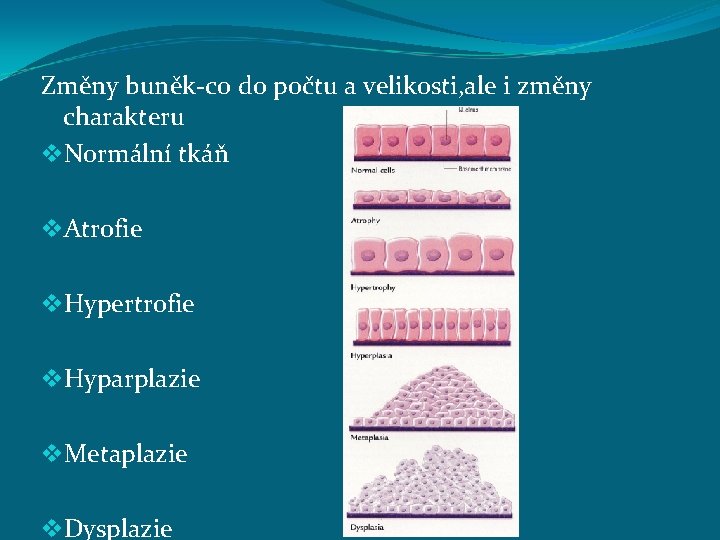 Změny buněk-co do počtu a velikosti, ale i změny charakteru v. Normální tkáň v.