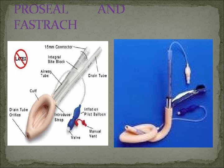PROSEAL FASTRACH AND 
