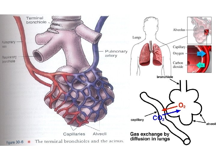 DISTURBANCES IN OXYGEN UTILIZATION Chronic Airflow Limitations CAL