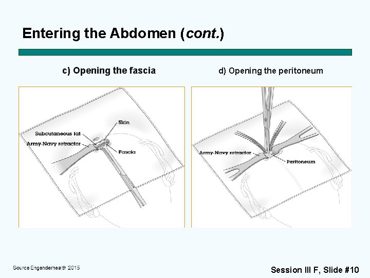 Entering the Abdomen (cont. ) c) Opening the fascia d) Opening the peritoneum Session