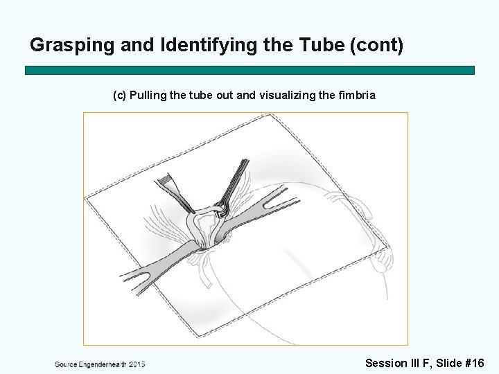Grasping and Identifying the Tube (cont) (c) Pulling the tube out and visualizing the