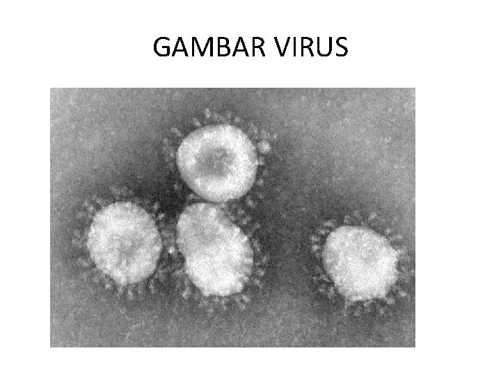 GAMBAR VIRUS 