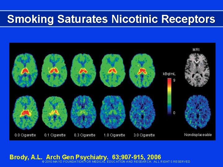 Smoking Saturates Nicotinic Receptors MRI k. Bq/m. L 9 0 0. 0 Cigarette 0.