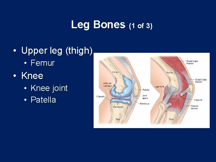 Leg Bones (1 of 3) • Upper leg (thigh) • Femur • Knee joint