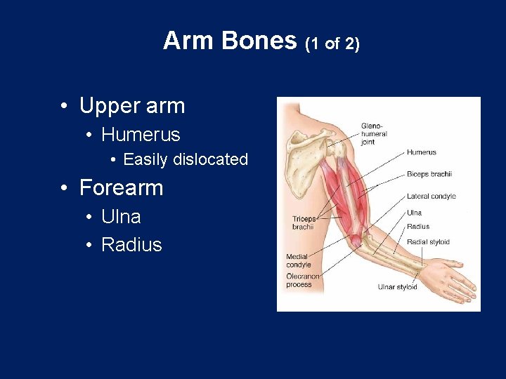 Arm Bones (1 of 2) • Upper arm • Humerus • Easily dislocated •