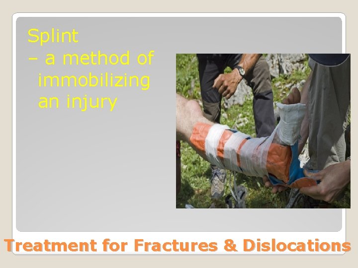 Splint – a method of immobilizing an injury Treatment for Fractures & Dislocations 