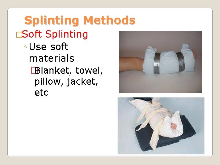 Splinting Methods �Soft Splinting ◦ Use soft materials � Blanket, towel, pillow, jacket, etc