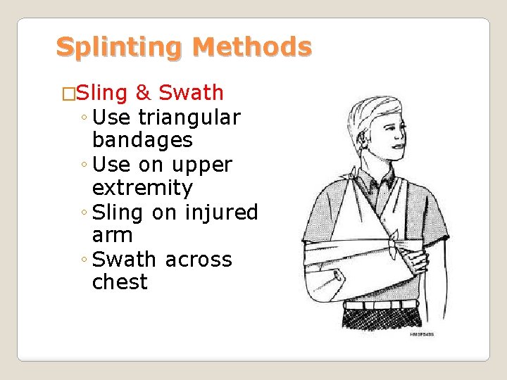 Splinting Methods �Sling & Swath ◦ Use triangular bandages ◦ Use on upper extremity