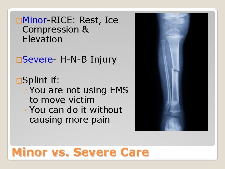 �Minor-RICE: Rest, Ice Compression & Elevation �Severe- H-N-B Injury �Splint if: ◦ You are