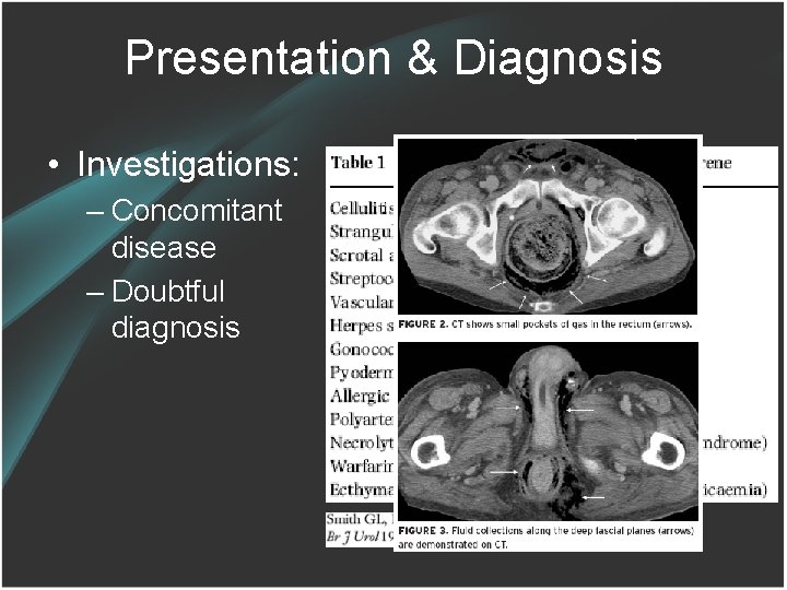 Presentation & Diagnosis • Investigations: – Concomitant disease – Doubtful diagnosis 