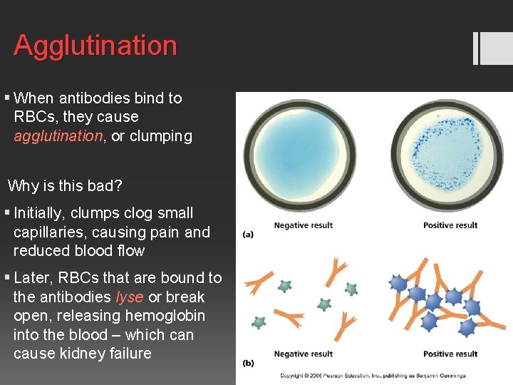 Agglutination § When antibodies bind to RBCs, they cause agglutination, or clumping Why is