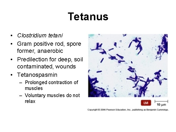 Tetanus • Clostridium tetani • Gram positive rod, spore former, anaerobic • Predilection for