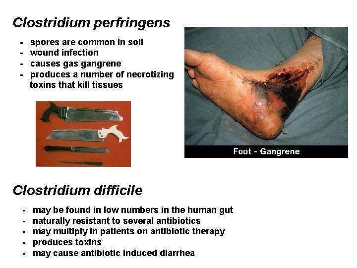 Clostridium perfringens - spores are common in soil wound infection causes gangrene produces a