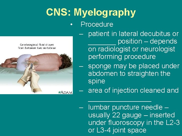CNS: Myelography • Procedure – patient in lateral decubitus or _______ position – depends