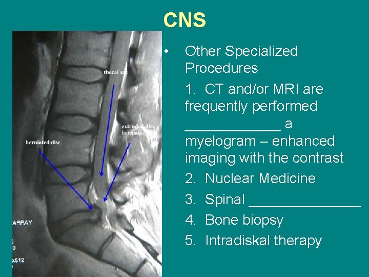 CNS • Other Specialized Procedures 1. CT and/or MRI are frequently performed ______ a