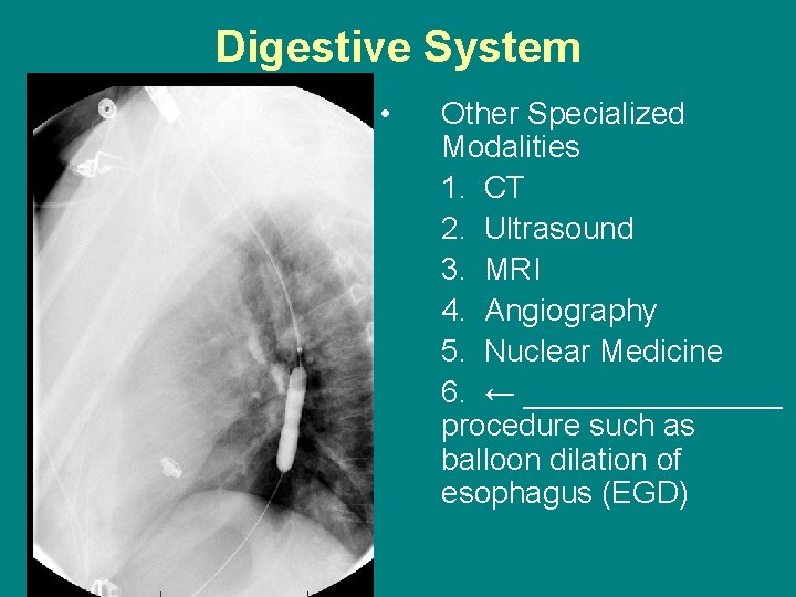 Digestive System • Other Specialized Modalities 1. CT 2. Ultrasound 3. MRI 4. Angiography