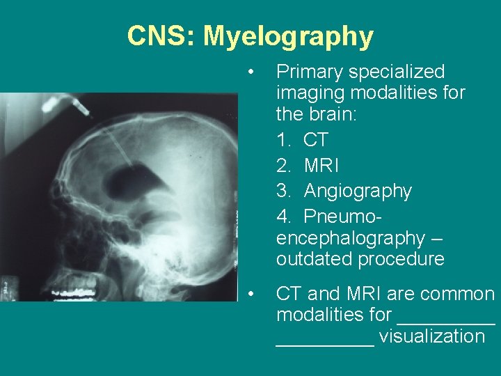 CNS: Myelography • Primary specialized imaging modalities for the brain: 1. CT 2. MRI